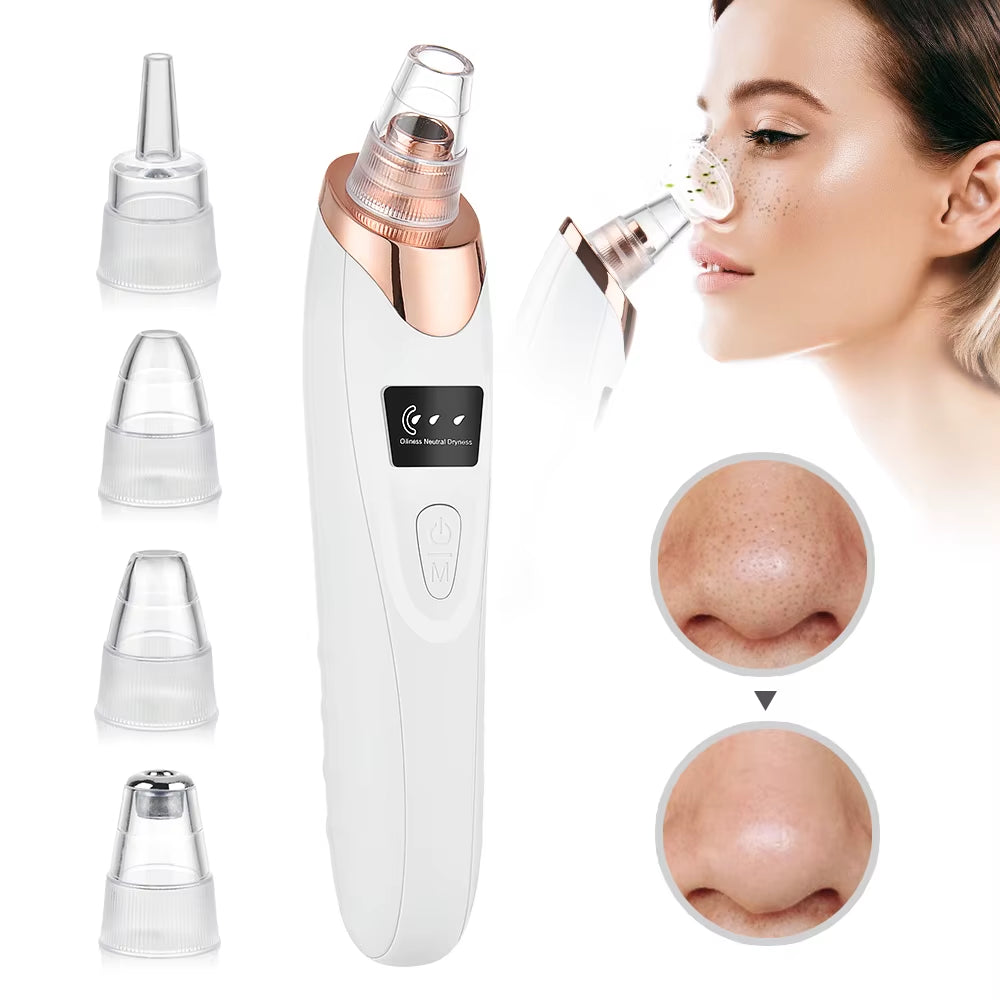 Facial Pore Cleaner, 5 Suction Power Blackhead Remover Pore Vacuum - USB Rechargeable Facial Pore Cleaner Kit